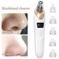 Electric Blackhead Remover | Vacuum Acne &amp; Pore Cleaner