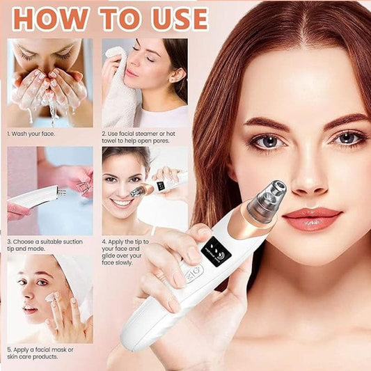 Electric Blackhead Remover | Vacuum Acne &amp; Pore Cleaner